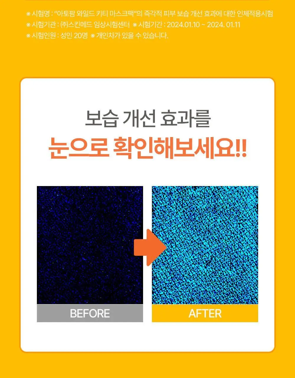 [만4~10세용] 아토팜 키즈 마스크팩 5매 3종 택1 상세페이지 18